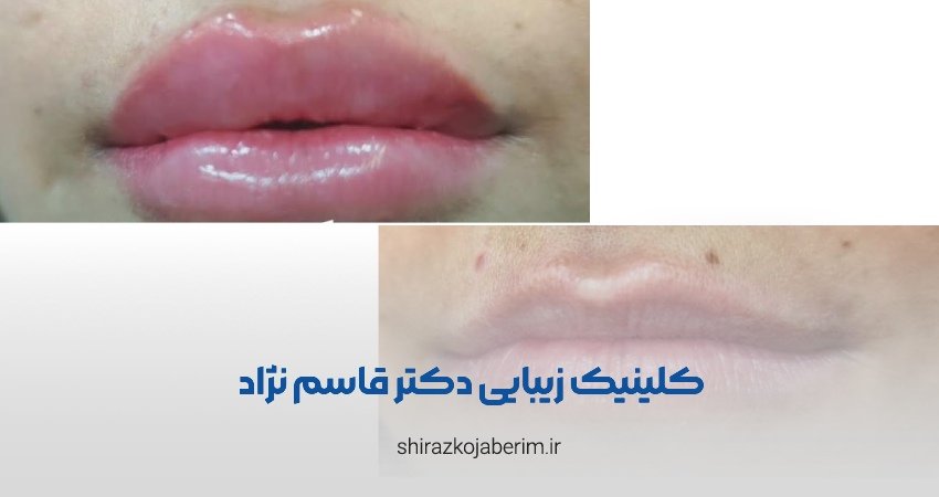 کلینیک زیبایی دکتر لیلا قاسم زاده شیراز