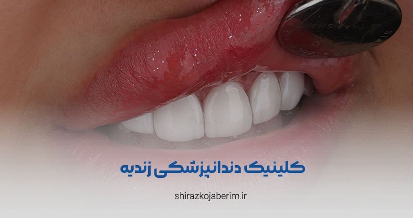 کلینیک دندانپزشکی زندیه شیراز