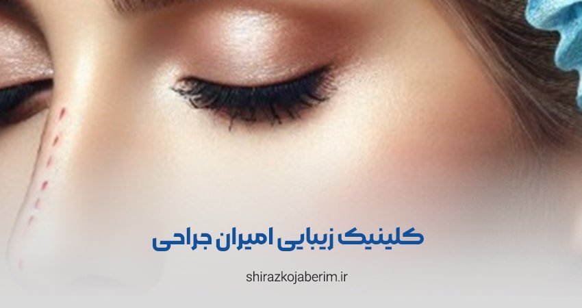 کلینیک زیبایی امیران جراحی شیراز