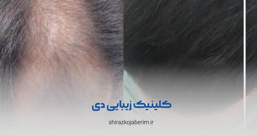 کلینیک زیبایی دی شیراز