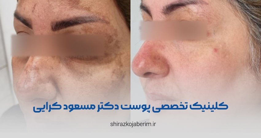 کلینیک تخصصی پوست دکتر مسعود کرایی شیراز