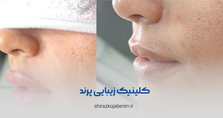 کلینیک زیبایی پرند شیراز