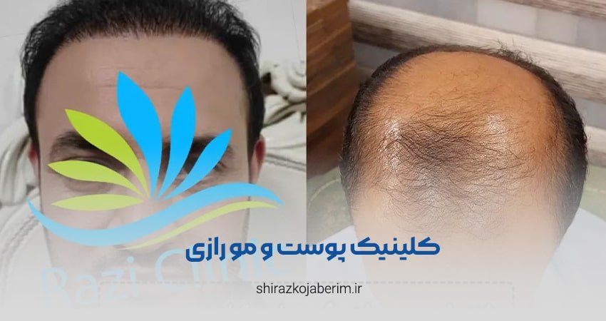 کلینیک پوست و مو رازی شیراز