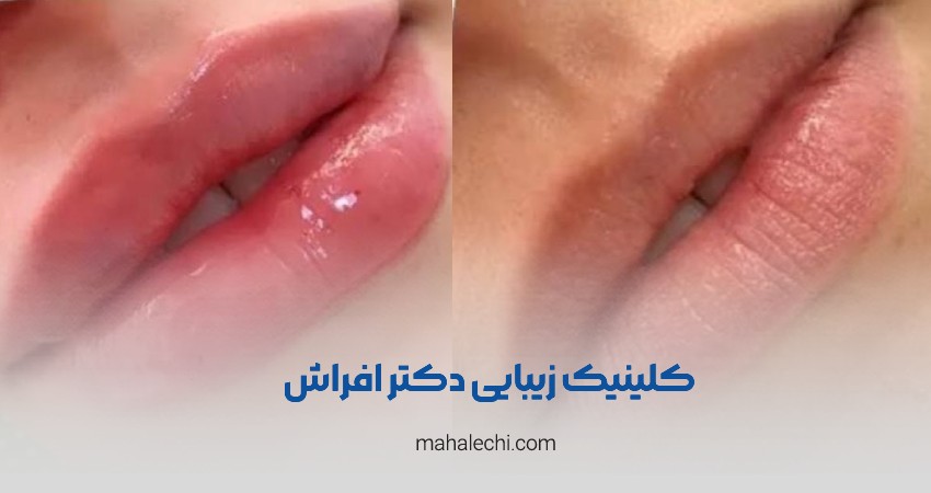 کلینیک زیبایی دکتر فرشته افراش شیراز
