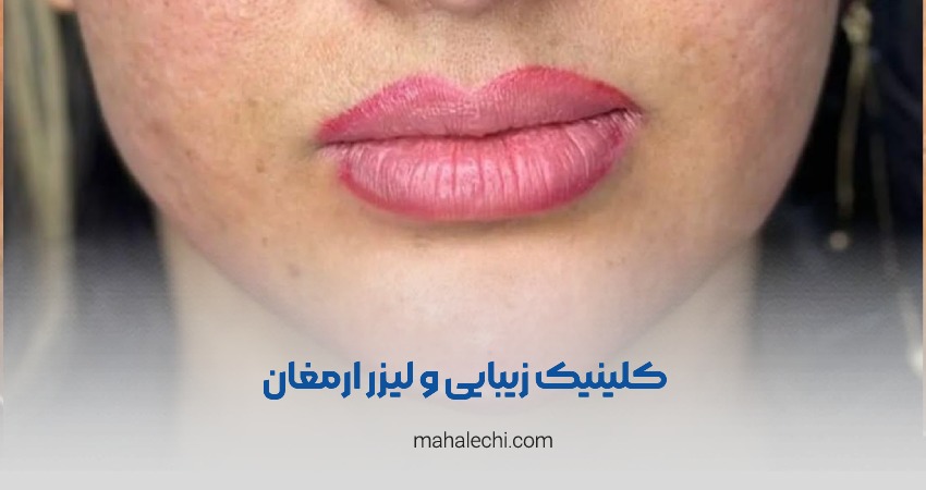 کلینیک زیبایی و لیزر ارمغان شیراز