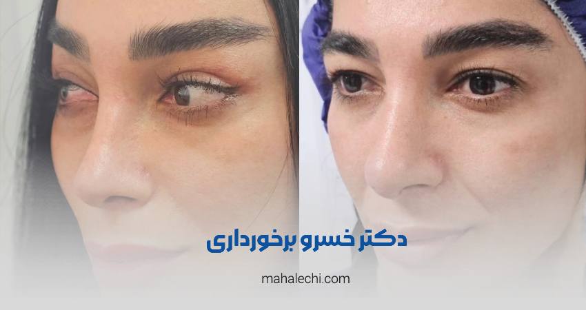 دکتر خسرو برخورداری متخصص و جراح گوش، حلق و بینی شیراز