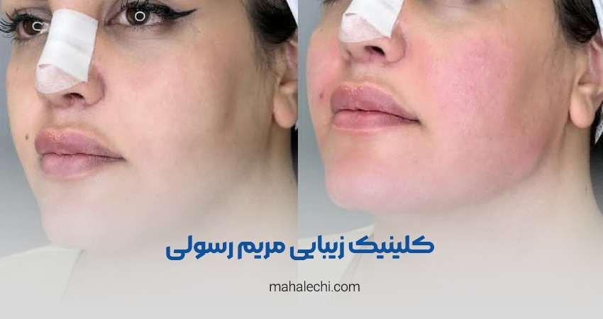 کلینیک زیبایی دکتر مریم رسولی شیراز