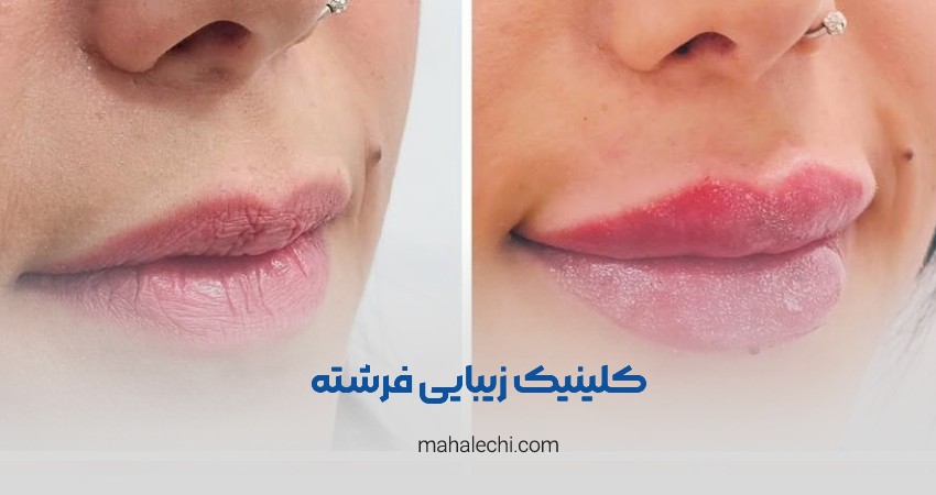 کلینیک زیبایی فرشته شیراز