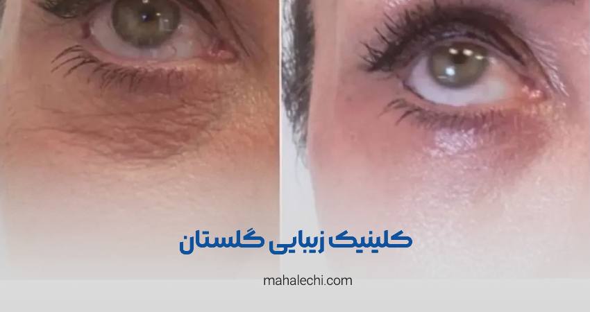 کلینیک زیبایی گلستان شیراز