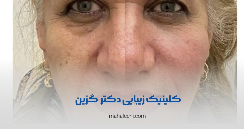 کلینیک دکتر لیلا گزین شیراز
