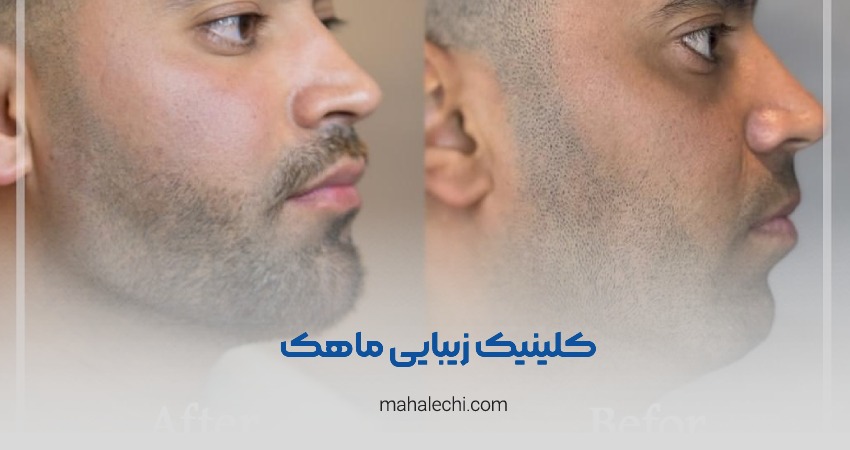 کلینیک زیبایی ماهک شیراز
