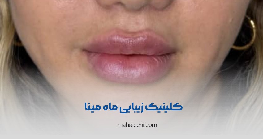کلینیک زیبایی ماه مینا شیراز