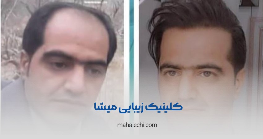 کلینیک زیبایی میشا شیراز