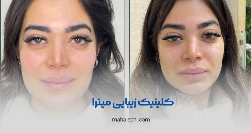 کلینیک زیبایی میترا شیراز