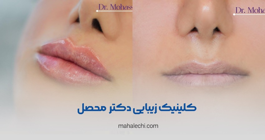 کلینیک دکتر نسترن محصل شیراز