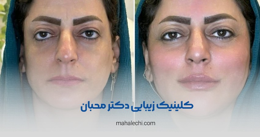 کلینیک زیبایی دکتر محبان شیراز