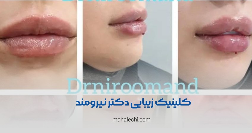 کلینیک زیبایی دکتر نیرومند شیراز