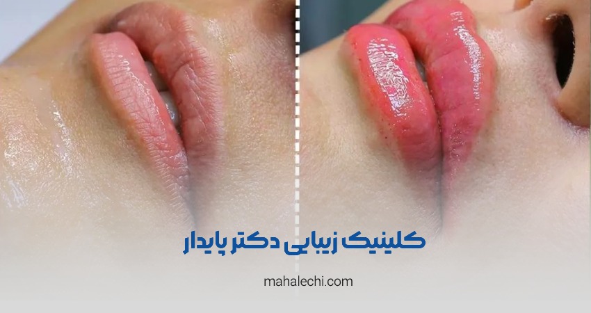 کلینیک زیبایی دکتر مریم پایدار شیراز