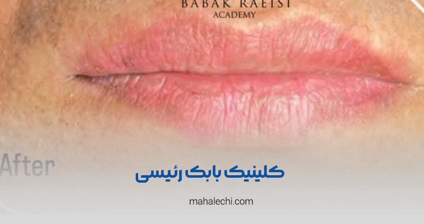 کلینیک بابک رئیسی شیراز