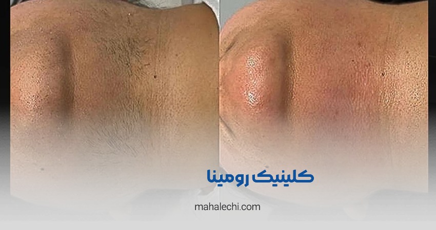کلینیک زیبایی رومینا شیراز