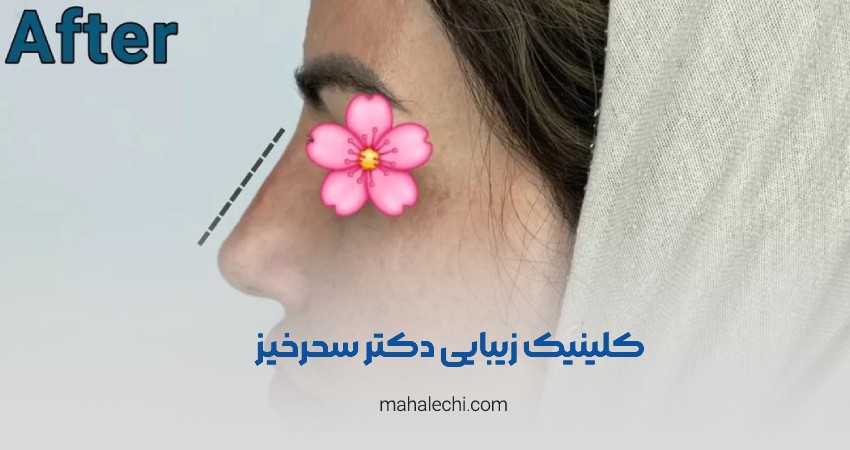 کلینیک زیبایی دکتر سحرخیز شیراز