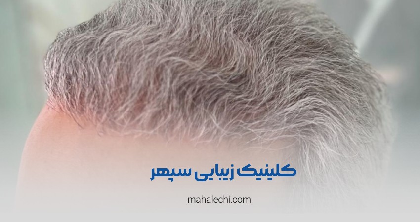 کلینیک زیبایی سپهر شیراز