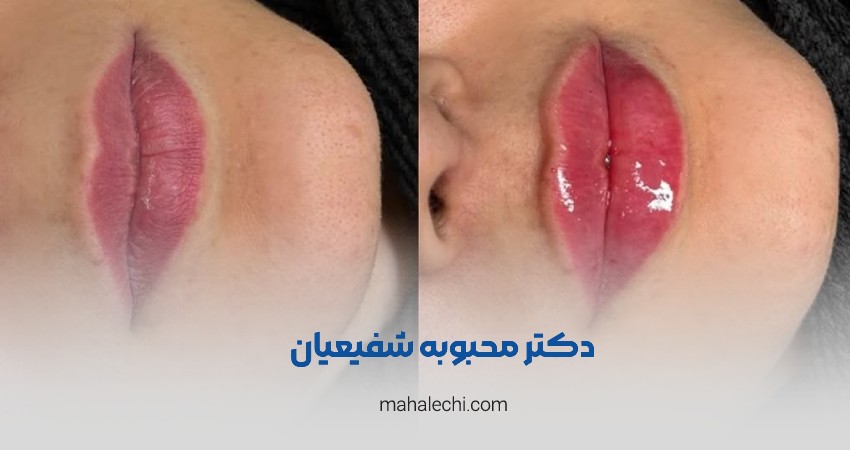 دکتر محبوبه شفیعیان متخصص پوست، مو و زیبایی شیراز