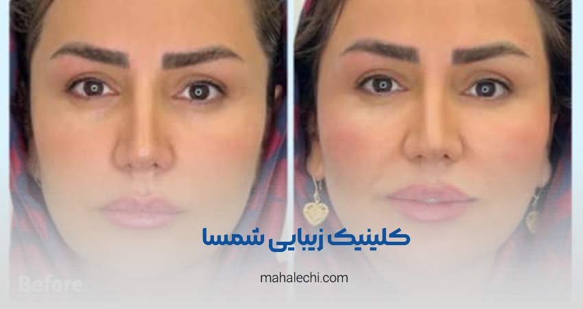 کلینیک زیبایی شمسا شیراز