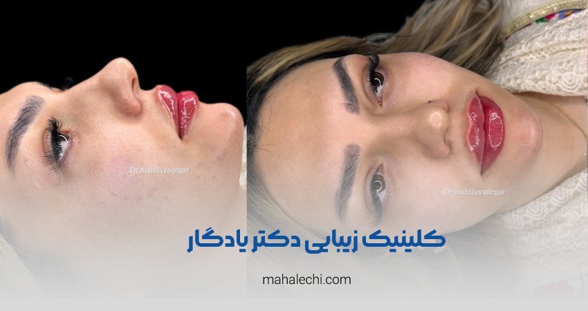 کلینیک زیبایی دکتر مهیلا یادگار شیراز