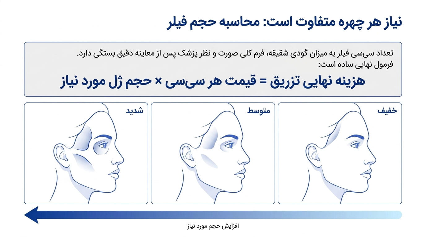 برای تزریق فیلر شقیقه چند سی‌سی ژل نیاز است؟